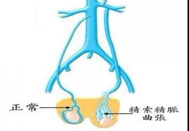 手术治疗