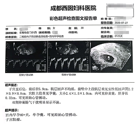 移植25天后，B超确认宫内早孕40+天，单孕囊，可见原始心管搏动。