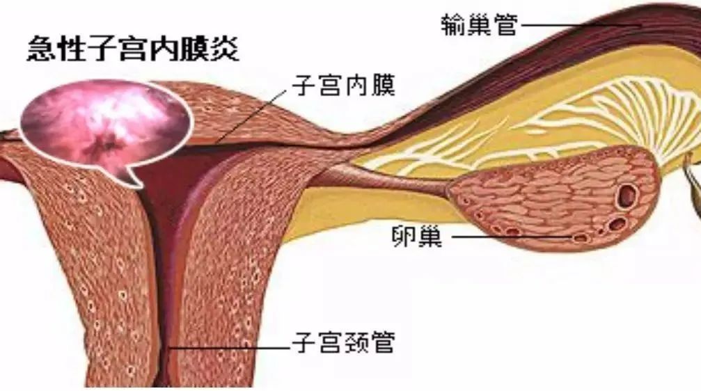 这个无症状的病很难发现，但却是胚胎的