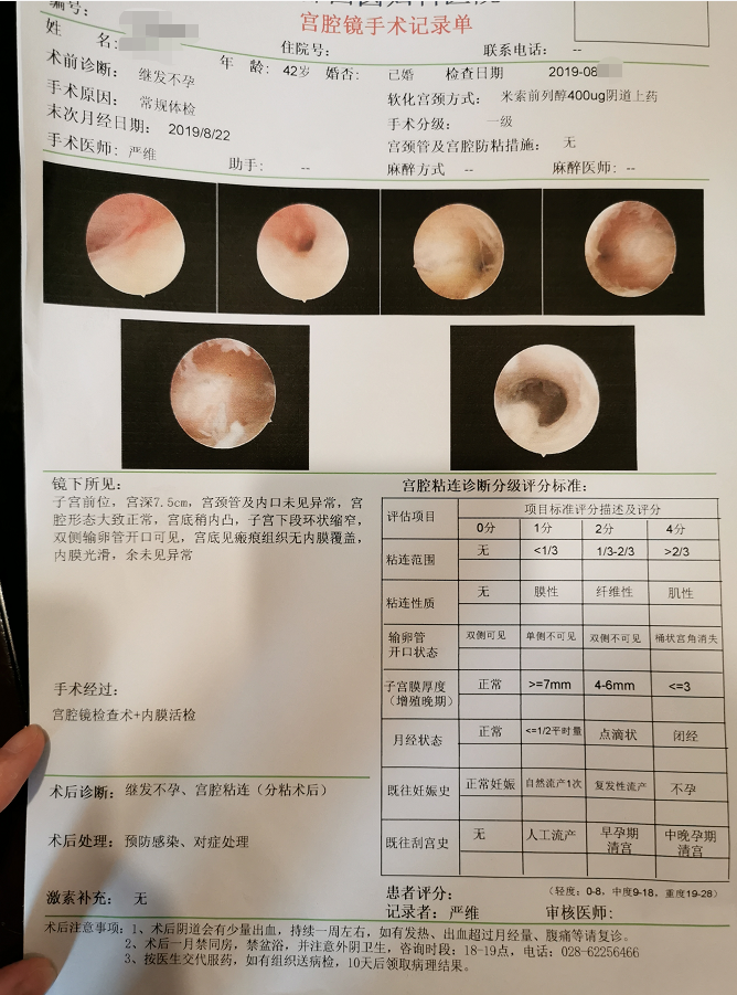 小静的宫腔镜检查结果